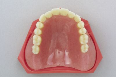 レジン床部分義歯（保険適応）