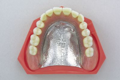 金属床義歯（自費）